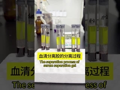 혈청 분리 젤은 어떻게 작동하나요?